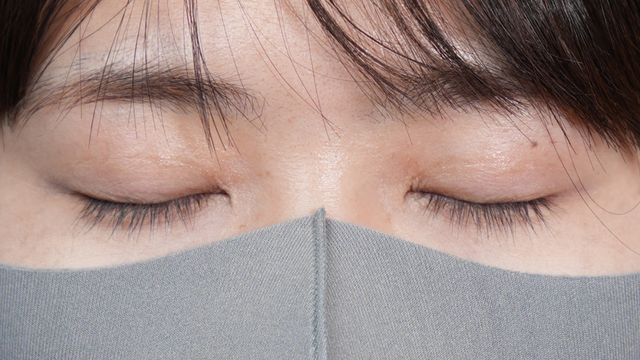 Postoperative Condition Part 1