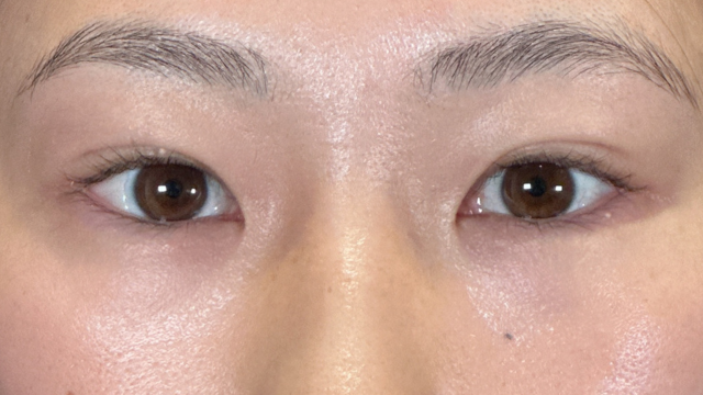 Postoperative Condition Part 1