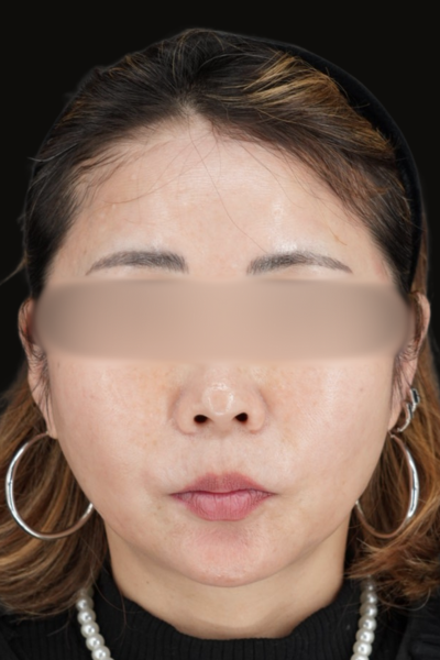 Postoperative Condition Part 1