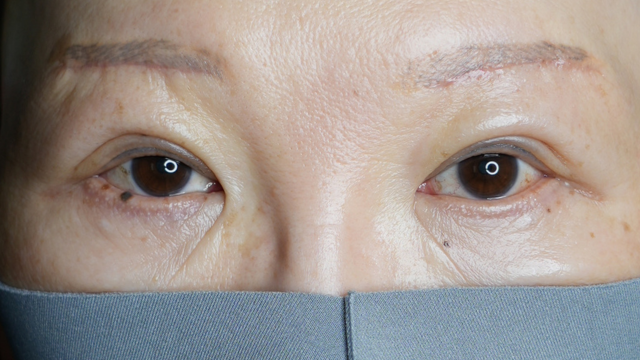 Postoperative Condition Part 1