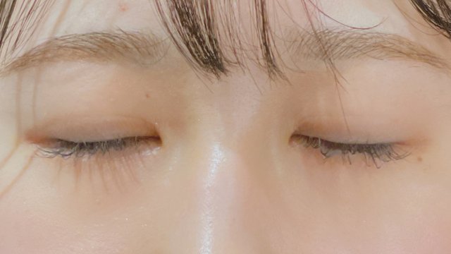 Postoperative Condition Part 1