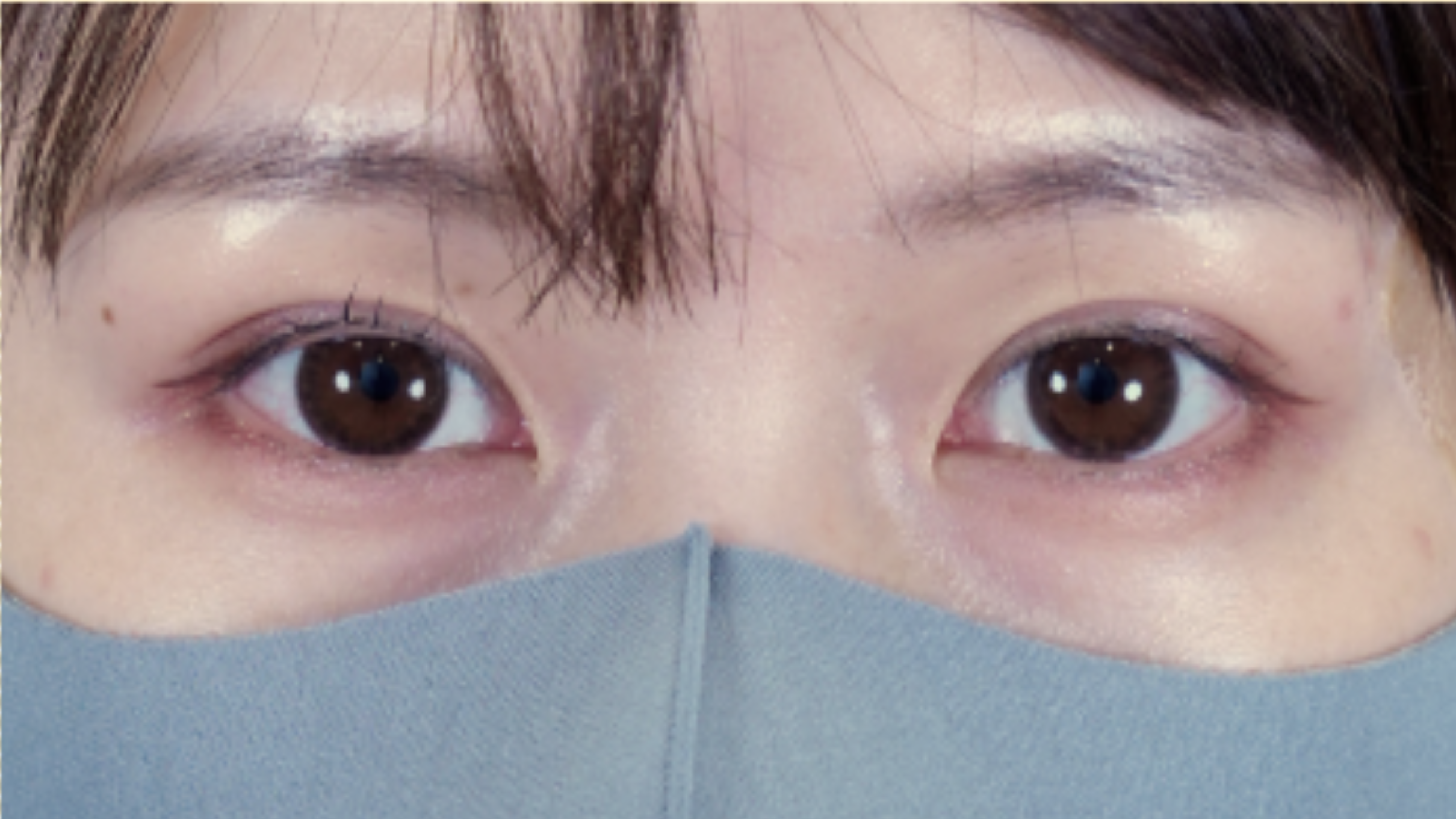 Postoperative Condition Part 1