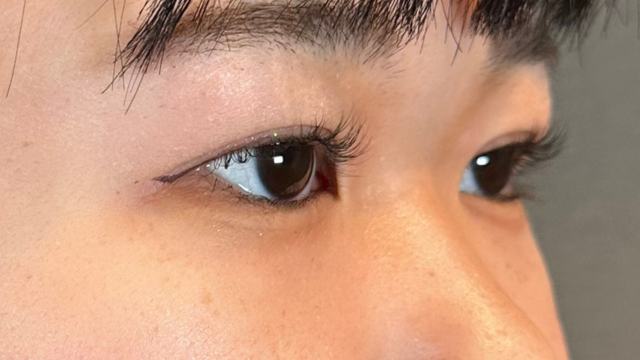 Postoperative Condition Part 1