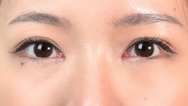 Postoperative Condition Part 1