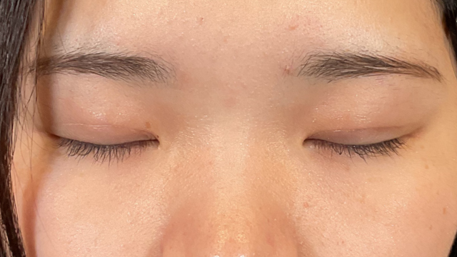 Postoperative Condition Part 1