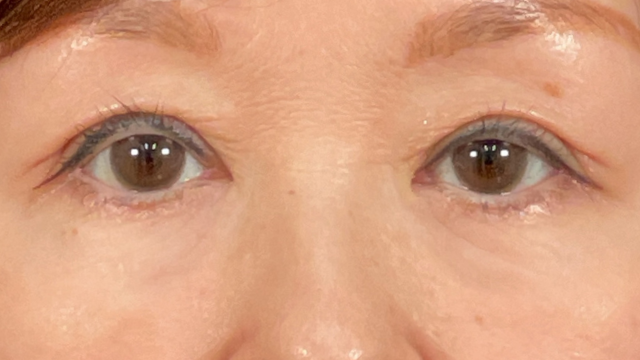 Postoperative Condition Part 1