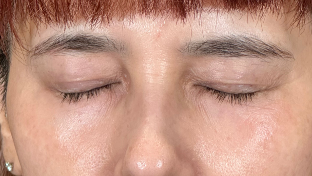 Postoperative Condition Part 1