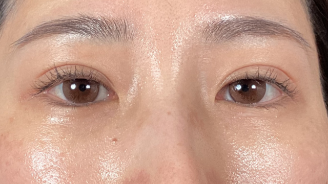 Postoperative Condition Part 1