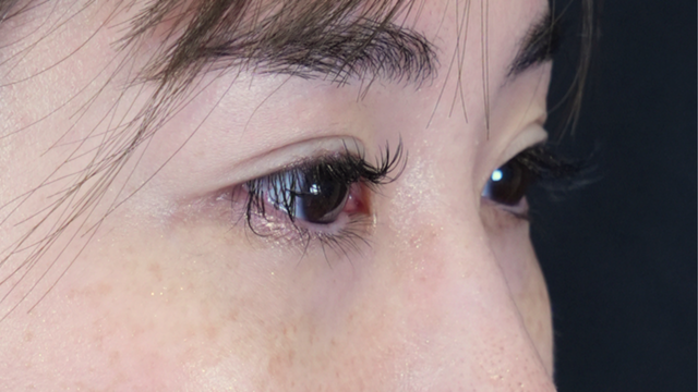 Postoperative Condition Part 1