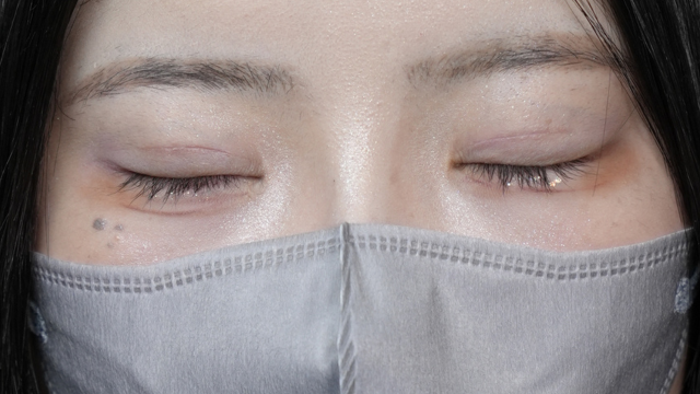 Postoperative Condition Part 1