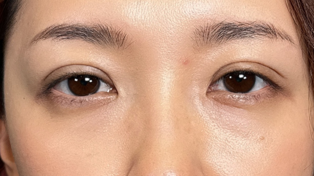 Postoperative Condition Part 1