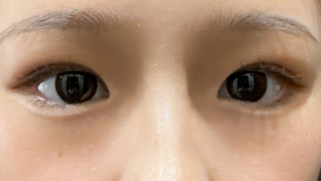 Postoperative Condition Part 1