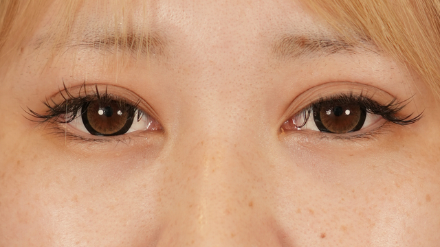 Postoperative Condition Part 1