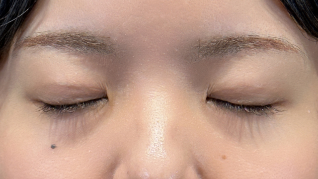 Postoperative Condition Part 1