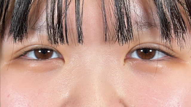 Postoperative Condition Part 1