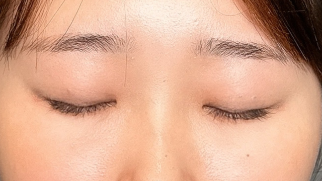 Postoperative Condition Part 1