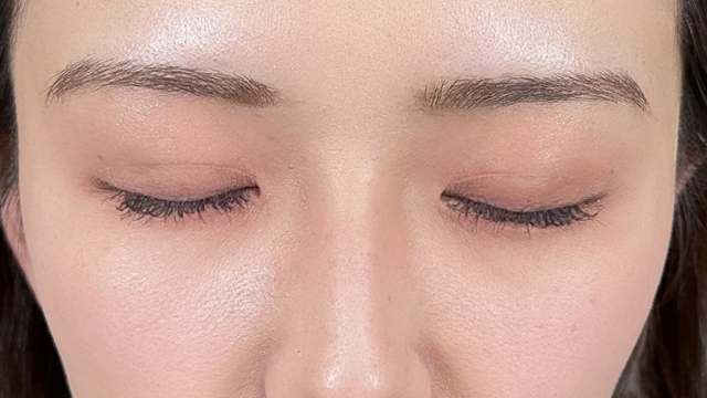 Postoperative Condition Part 1