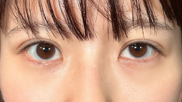 Postoperative Condition Part 1