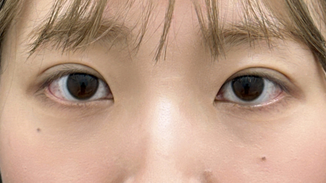 Postoperative Condition Part 1