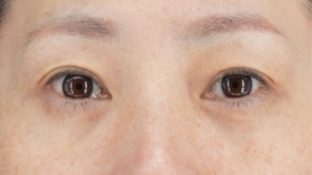 Postoperative Condition Part 1