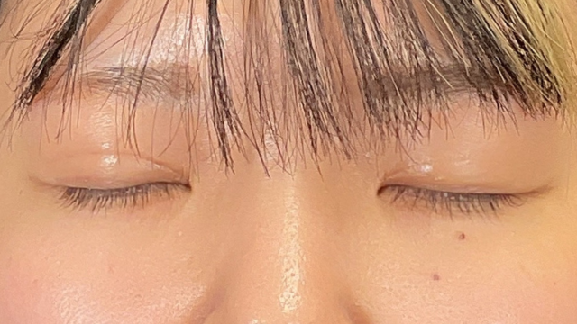 Postoperative Condition Part 1