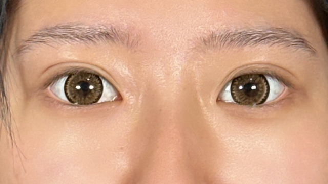 Postoperative Condition Part 1