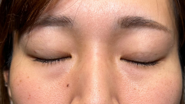 Postoperative Condition Part 1