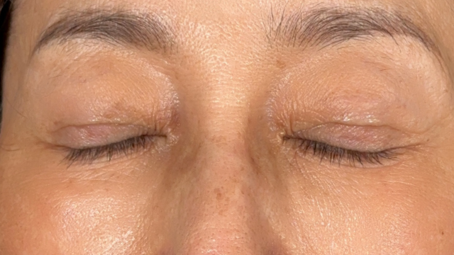 Postoperative Condition Part 1