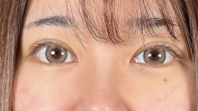 Postoperative Condition Part 1