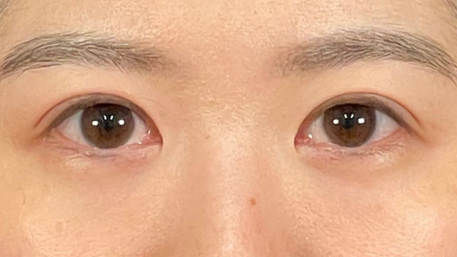 Postoperative Condition Part 1