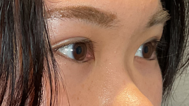 Postoperative Condition Part 1