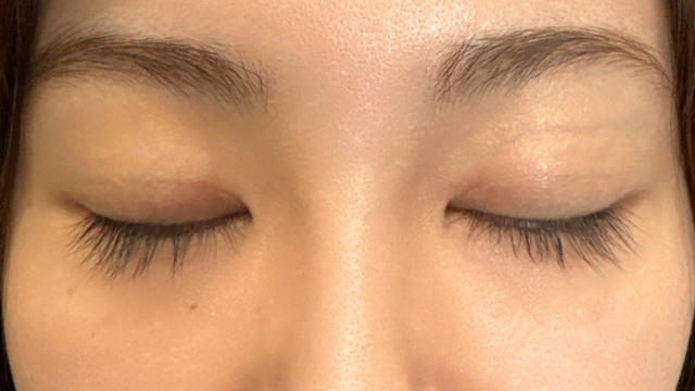 Postoperative Condition Part 1