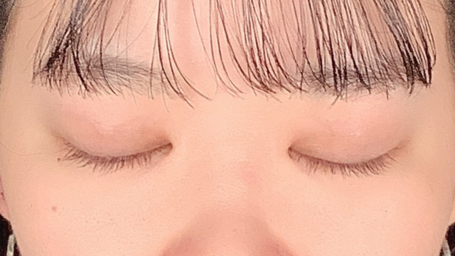 Postoperative Condition Part 1