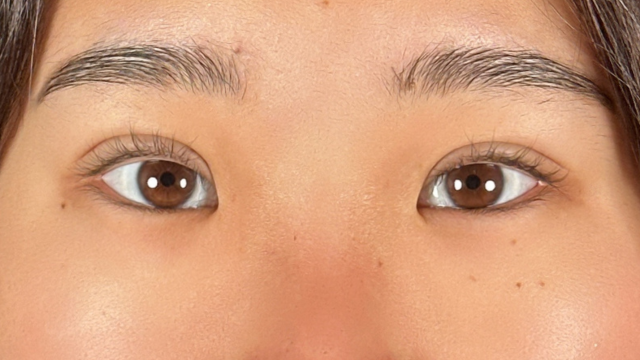 Postoperative Condition Part 1