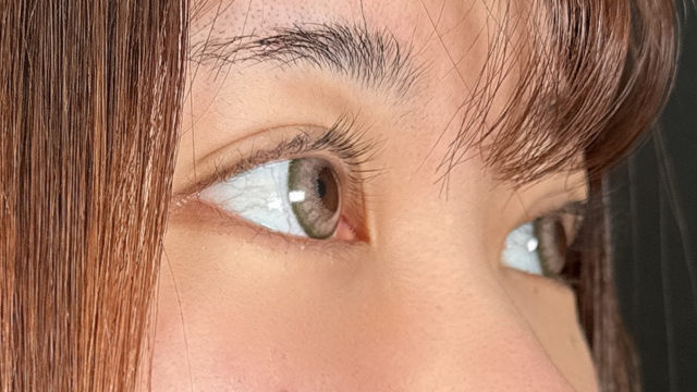 Postoperative Condition Part 1