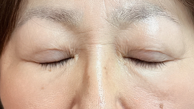 Postoperative Condition Part 1