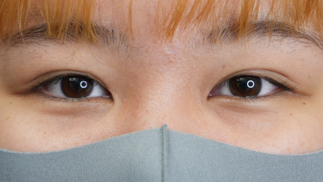 Postoperative Condition Part 1