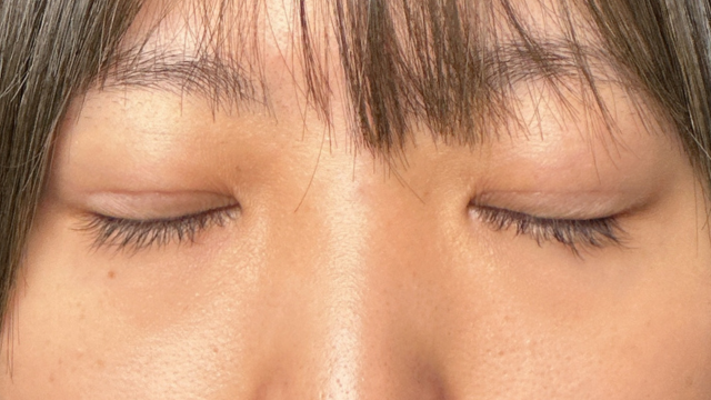 Postoperative Condition Part 1