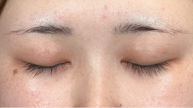 Postoperative Condition Part 1