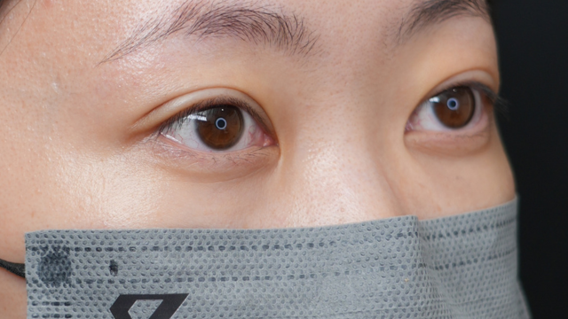 Postoperative Condition Part 1