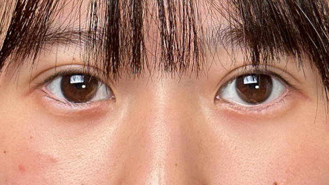 Postoperative Condition Part 1