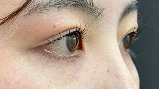 Postoperative Condition Part 1