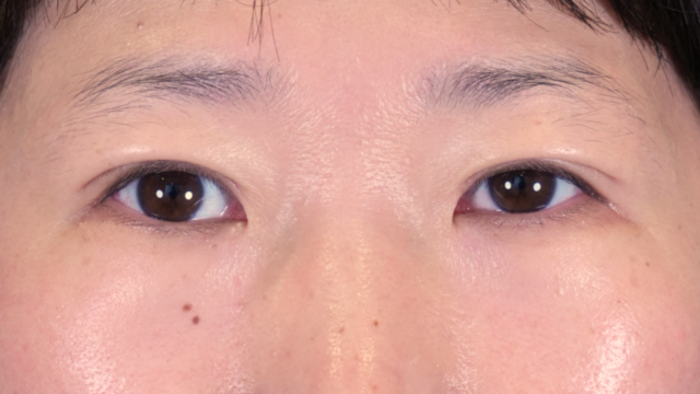 Postoperative Condition Part 1