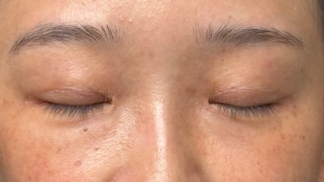 Postoperative Condition Part 1