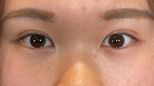 Postoperative Condition Part 1