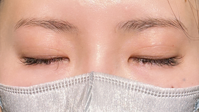 Postoperative Condition Part 1