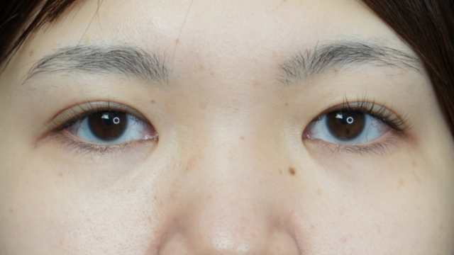 Postoperative Condition Part 1