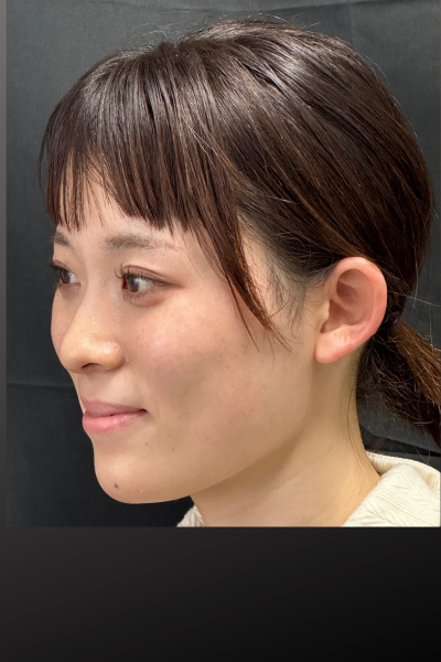 Postoperative Condition Part 1