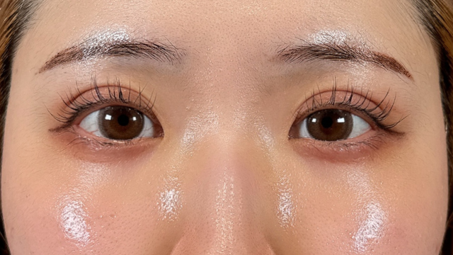 Postoperative Condition Part 1