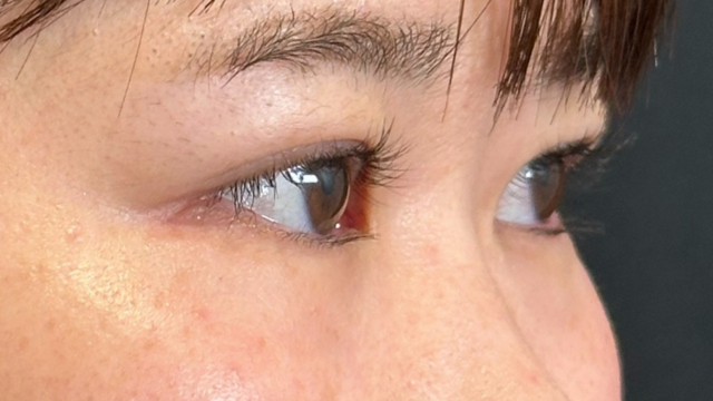 Postoperative Condition Part 1